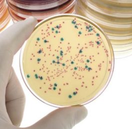 Proti mikrobům se musíme naučit bránit, ne je ničit